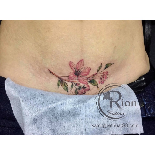 Hình Xăm Che Sẹo