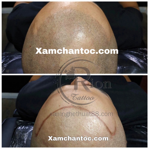 Xăm Chân Tóc